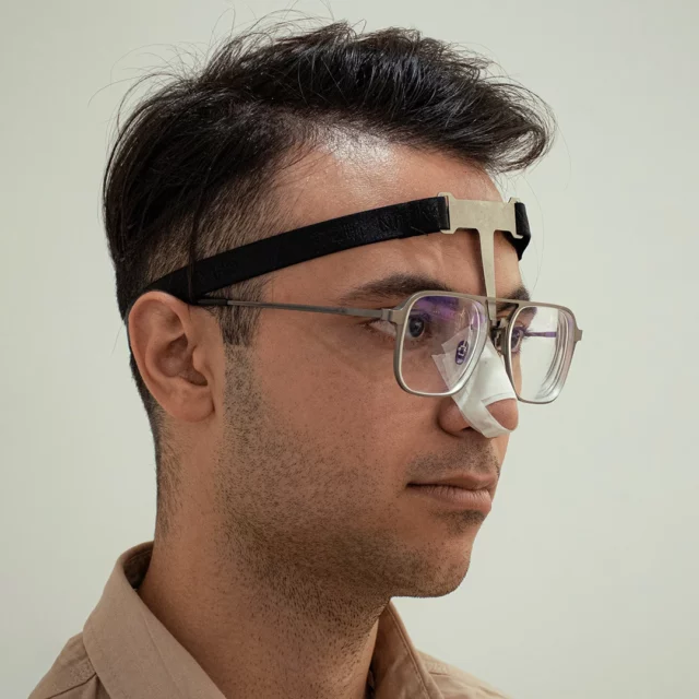 نگهدارنده عینک بعد از عمل بینی