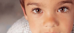 تنبلی چشم در کودکان چگونه درمان می شود؟